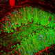 Image for article titled The Astounding And Horrific World As Seen Under A Microscope
